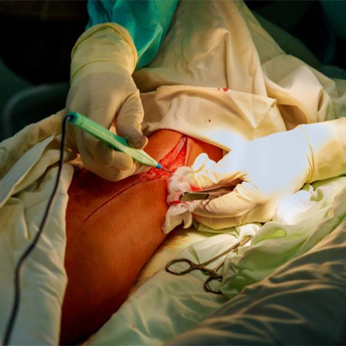 Trauma and Limb Reconstruction Surgery